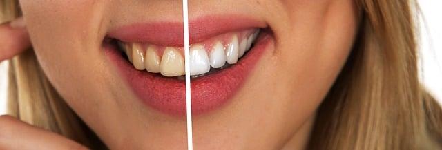 Jak správně čistit zuby a péči o dásně